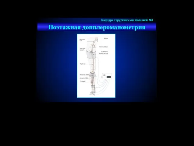 Поэтажная допплероманометрия