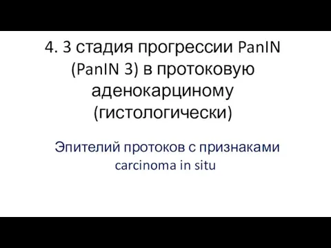 4. 3 стадия прогрессии PanIN (PanIN 3) в протоковую аденокарциному (гистологически) Эпителий протоков