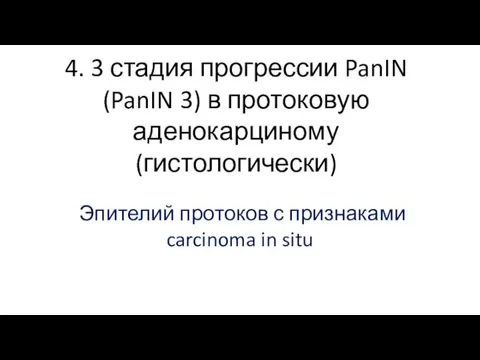 4. 3 стадия прогрессии PanIN (PanIN 3) в протоковую аденокарциному