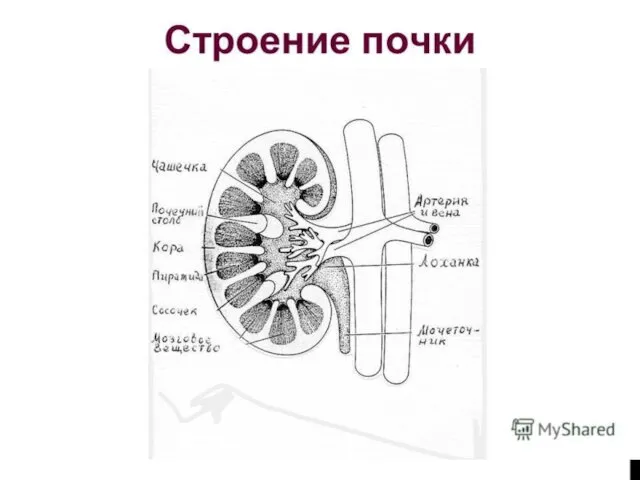 КЛАССИФИКАЦИЯ 1 Аномалии количества почек: а) Аплазия б) Удвоение почки