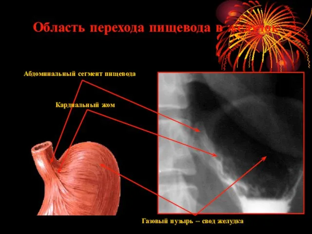 Область перехода пищевода в желудок Газовый пузырь – свод желудка Абдоминальный сегмент пищевода Кардиальный жом