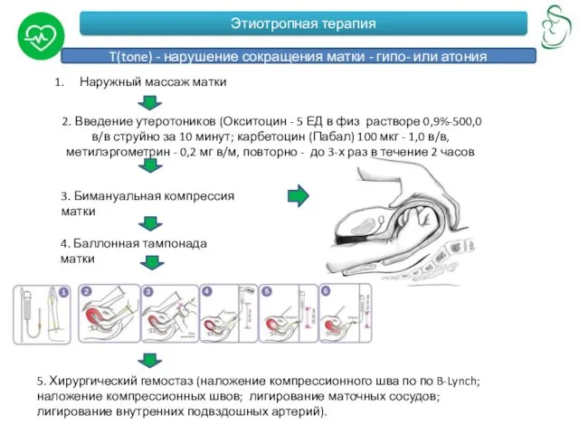 Этиотропная терапия T(tone) - нарушение сокращения матки - гипо- или