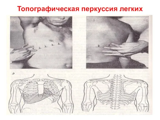 Топографическая перкуссия легких