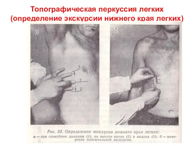 Топографическая перкуссия легких (определение экскурсии нижнего края легких)