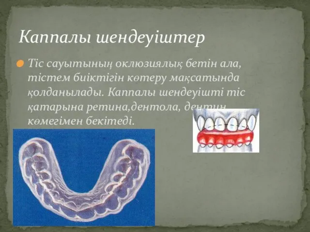 Каппалы шендеуіштер Тіс сауытының оклюзиялық бетін ала, тістем биіктігін көтеру мақсатында қолданылады. Каппалы