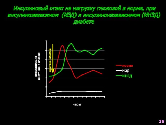 Инсулиновый ответ на нагрузку глюкозой в норме, при инсулинозависимом (ИЗД)