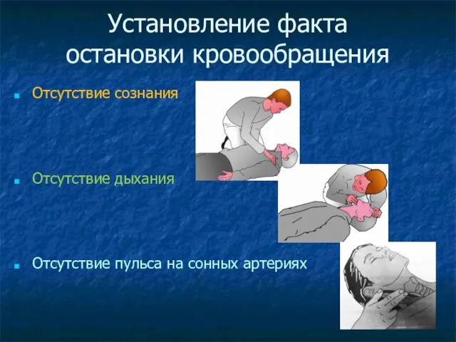 Установление факта остановки кровообращения Отсутствие сознания Отсутствие дыхания Отсутствие пульса на сонных артериях