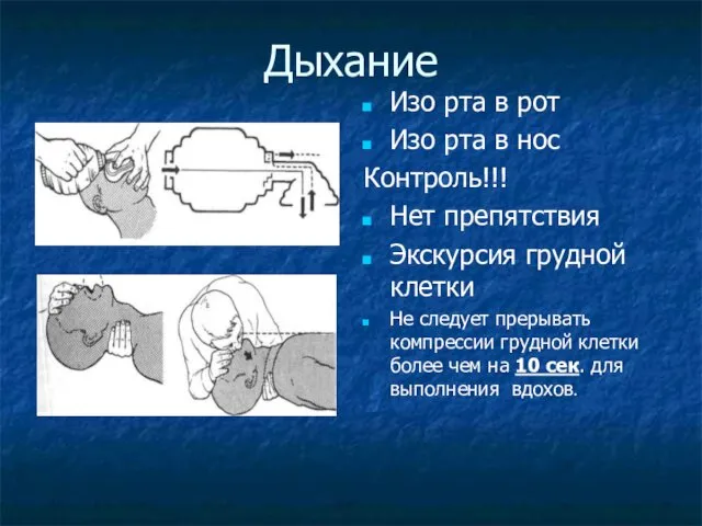 Дыхание Изо рта в рот Изо рта в нос Контроль!!!