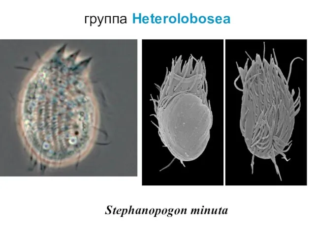 группа Heterolobosea Stephanopogon minuta