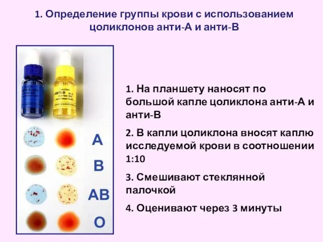 1. Определение группы крови с использованием цоликлонов анти-А и анти-В