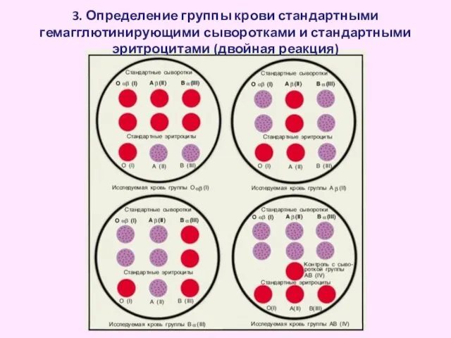 3. Определение группы крови стандартными гемагглютинирующими сыворотками и стандартными эритроцитами (двойная реакция)
