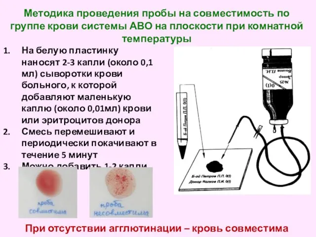 Методика проведения пробы на совместимость по группе крови системы АВО