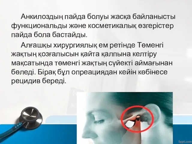 Анкилоздың пайда болуы жасқа байланысты функциональды және косметикалық өзгерістер пайда