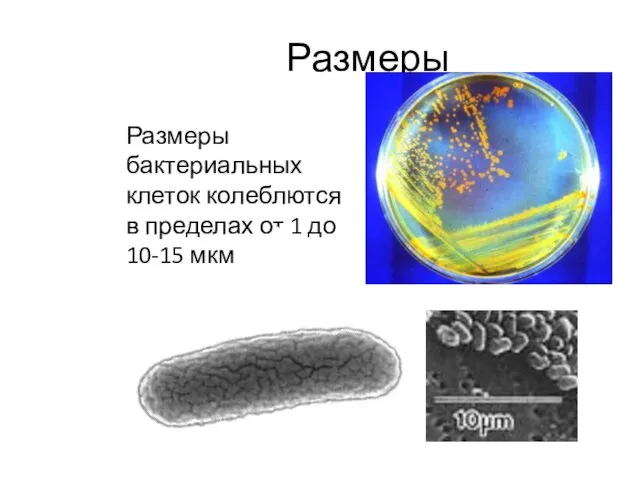 Размеры Размеры бактериальных клеток колеблются в пределах от 1 до 10-15 мкм