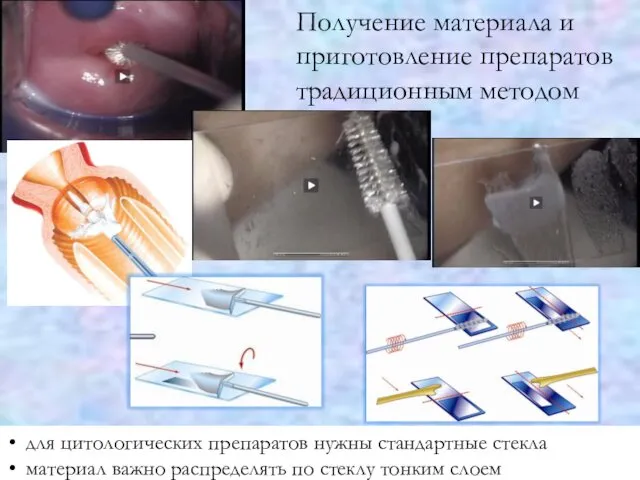 Получение материала и приготовление препаратов традиционным методом для цитологических препаратов нужны стандартные стекла