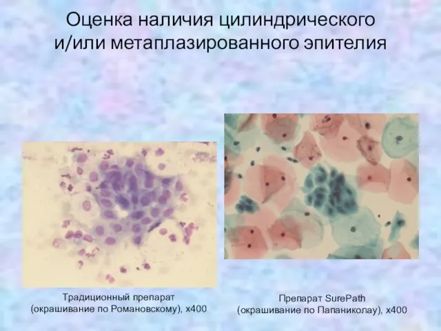 Оценка наличия цилиндрического и/или метаплазированного эпителия Традиционный препарат (окрашивание по