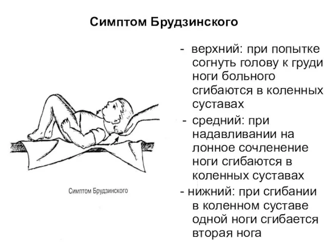 Симптом Брудзинского - верхний: при попытке согнуть голову к груди ноги больного сгибаются