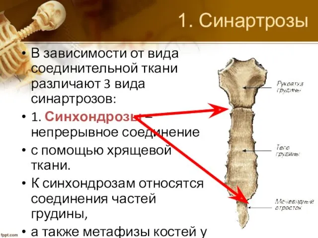 1. Синартрозы В зависимости от вида соединительной ткани различают 3