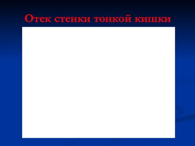 Отек стенки тонкой кишки