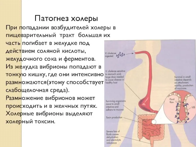 Патогнез холеры При попадании возбудителей холеры в пищеварительный тракт большая