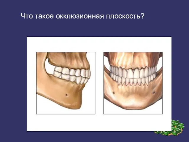 Что такое окклюзионная плоскость?