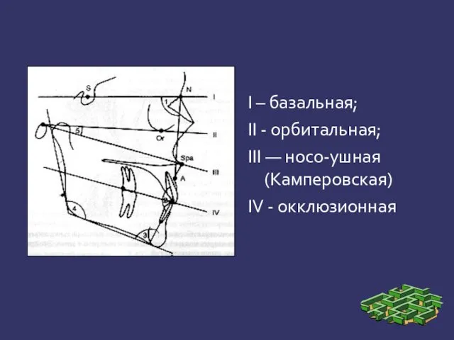 I – базальная; II - орбитальная; III — носо-ушная (Камперовская) IV - окклюзионная