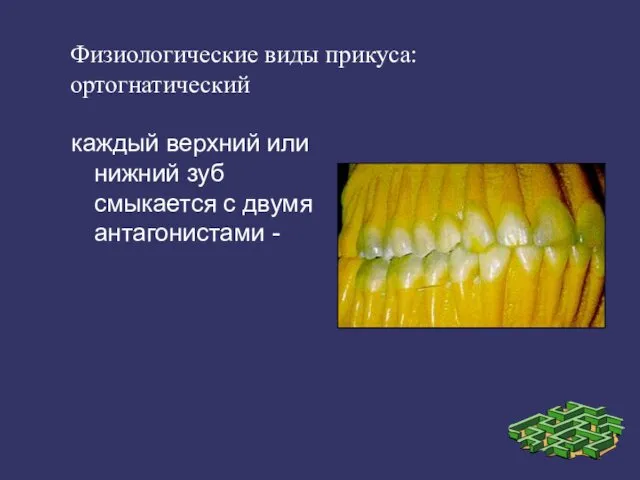 Физиологические виды прикуса: ортогнатический каждый верхний или нижний зуб смыкается с двумя антагонистами -