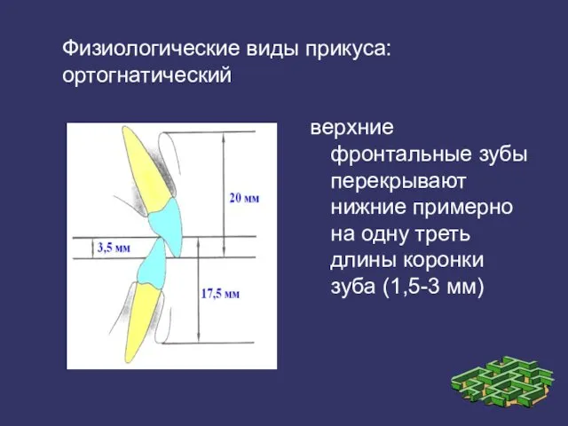 Физиологические виды прикуса: ортогнатический верхние фронтальные зубы перекрывают нижние примерно