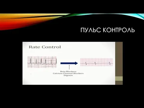 ПУЛЬС КОНТРОЛЬ