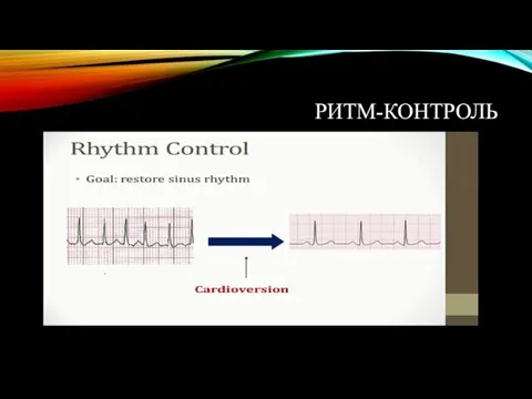 РИТМ-КОНТРОЛЬ
