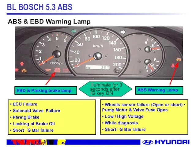 EBD & Parking brake lamp • ECU Failure • Solenoid Valve Failure •