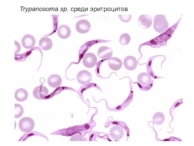 Trypanosoma sp. среди эритроцитов