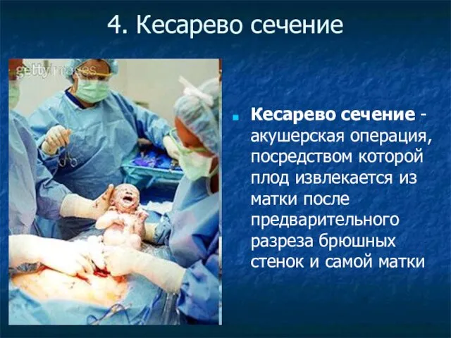 4. Кесарево сечение Кесарево сечение - акушерская операция, посредством которой плод извлекается из