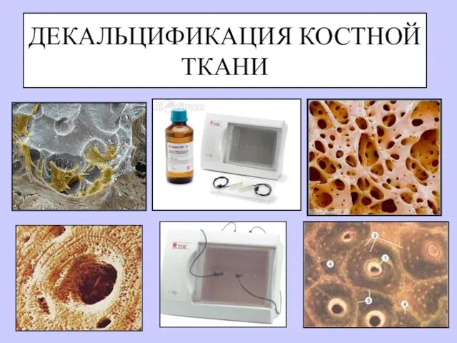 ДЕКАЛЬЦИФИКАЦИЯ КОСТНОЙ ТКАНИ