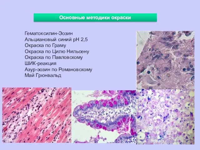 Основные методики окраски Гематоксилин-Эозин Альциановый синий рН 2,5 Окраска по