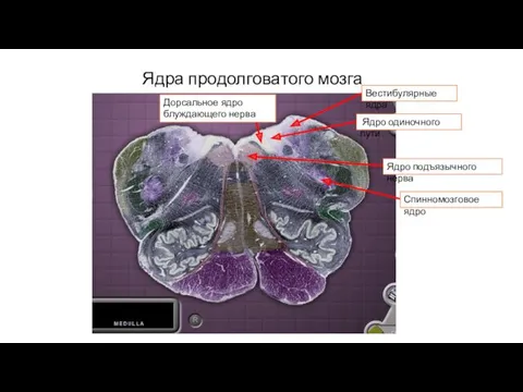 Ядра продолговатого мозга Вестибулярные ядра Ядро одиночного пути Дорсальное ядро