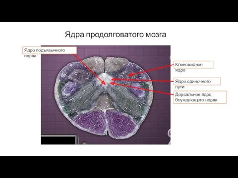 Ядра продолговатого мозга Клиновидное ядро Ядро одиночного пути Дорсальное ядро блуждающего нерва Ядро подъязычного нерва