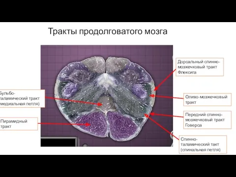 Тракты продолговатого мозга Бульбо-таламический тракт (медиальная петля) Дорсальный спинно-мозжечковый тракт