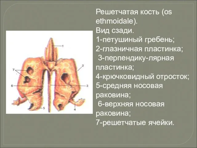 Решетчатая кость (os ethmoidale). Вид сзади. 1-петушиный гребень; 2-глазничная пластинка;