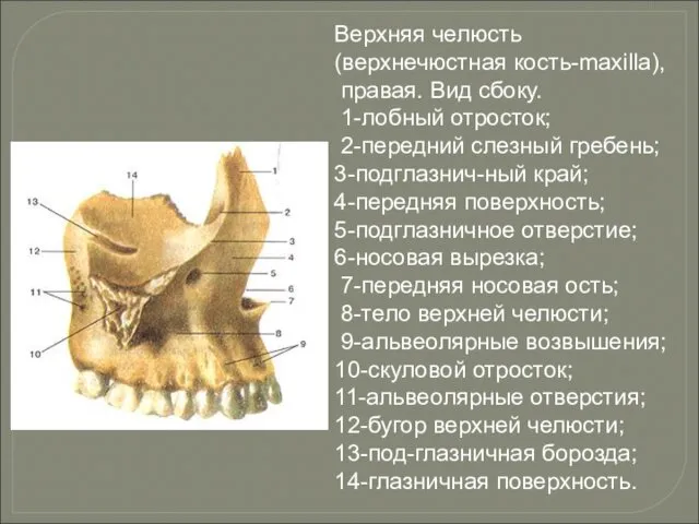 Верхняя челюсть (верхнечюстная кость-maxilla), правая. Вид сбоку. 1-лобный отросток; 2-передний