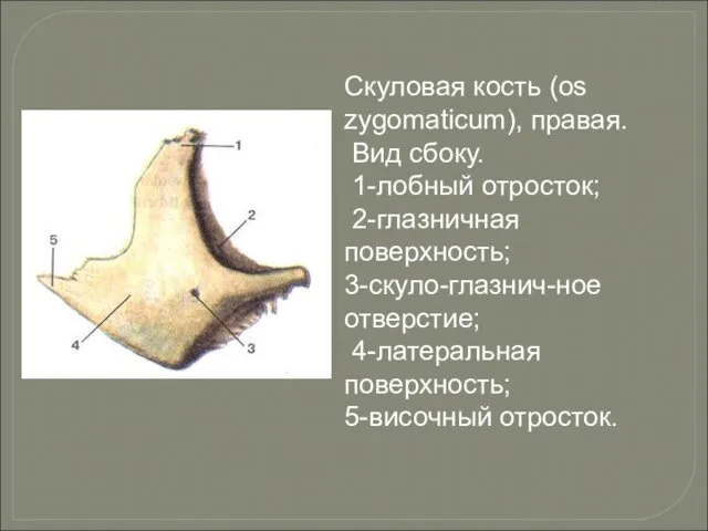 Скуловая кость (os zygomaticum), правая. Вид сбоку. 1-лобный отросток; 2-глазничная