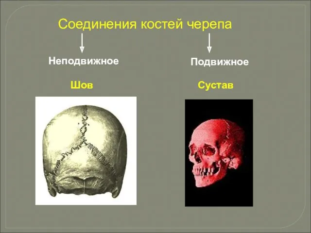 Соединения костей черепа Неподвижное Подвижное Шов Сустав