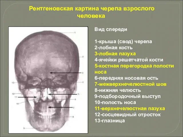 Вид спереди 1-крыша (свод) черепа 2-лобная кость 3-лобная пазуха 4-ячейки