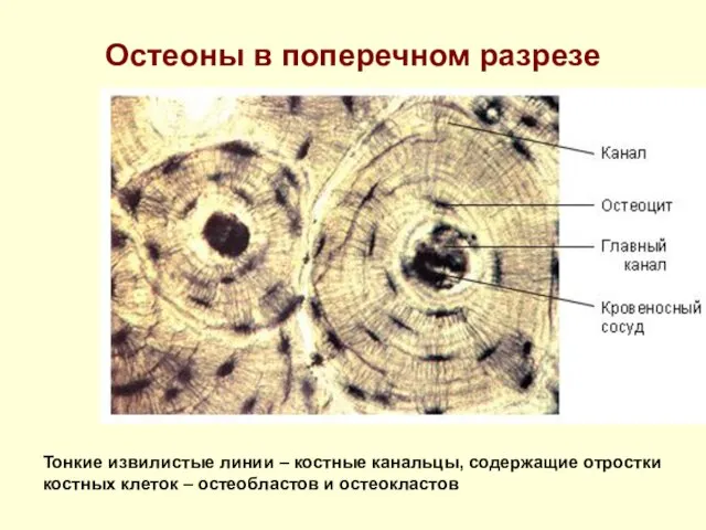 Остеоны в поперечном разрезе Тонкие извилистые линии – костные канальцы,