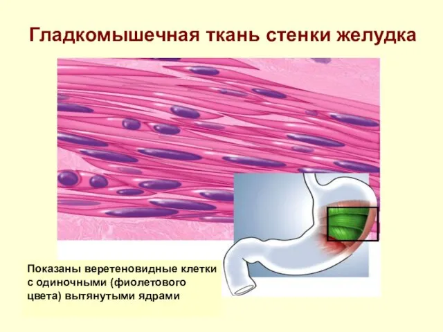 Гладкомышечная ткань стенки желудка Показаны веретеновидные клетки с одиночными (фиолетового цвета) вытянутыми ядрами