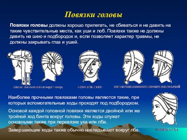 Повязки головы Повязки головы должны хорошо прилегать, не сбиваться и