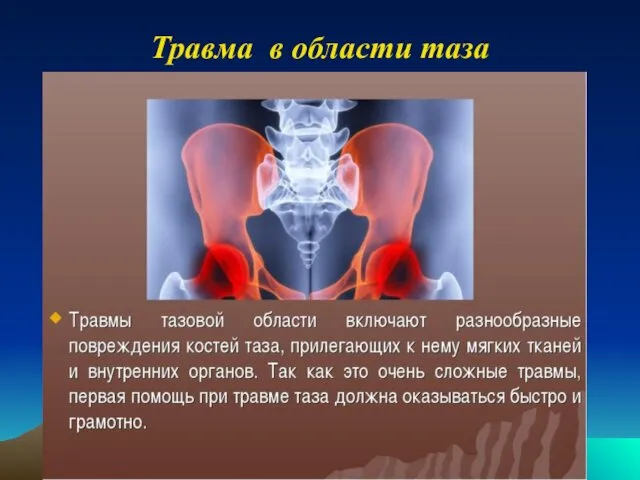 Травма в области таза