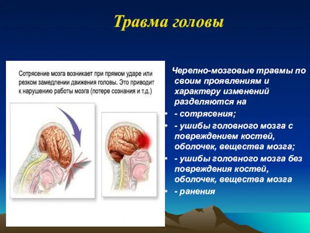 Черепно-мозговые травмы по своим проявлениям и характеру изменений разделяются на