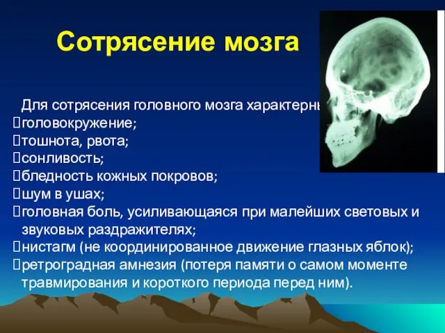 Сотрясение мозга Для сотрясения головного мозга характерными являются: головокружение; тошнота,