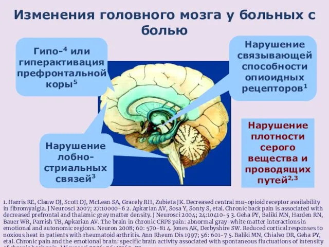 Изменения головного мозга у больных с болью 1. Harris RE,